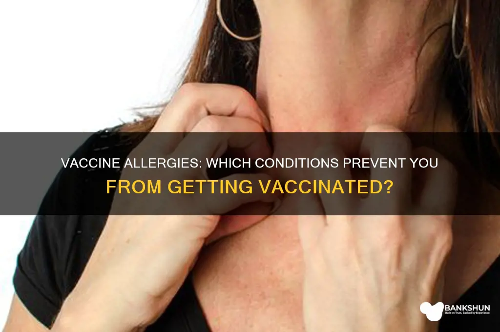 what allergies stop you having the vaccine