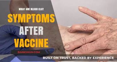 Recognizing Blood Clot Symptoms Post-Vaccination: What You Need to Know