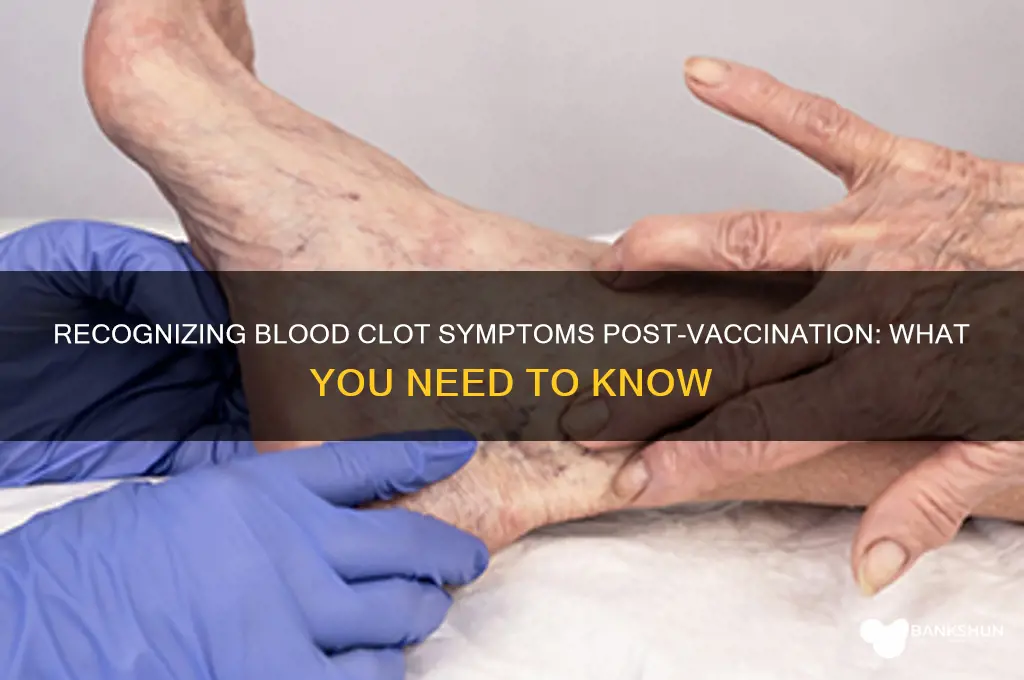 what are blood clot symptoms after vaccine
