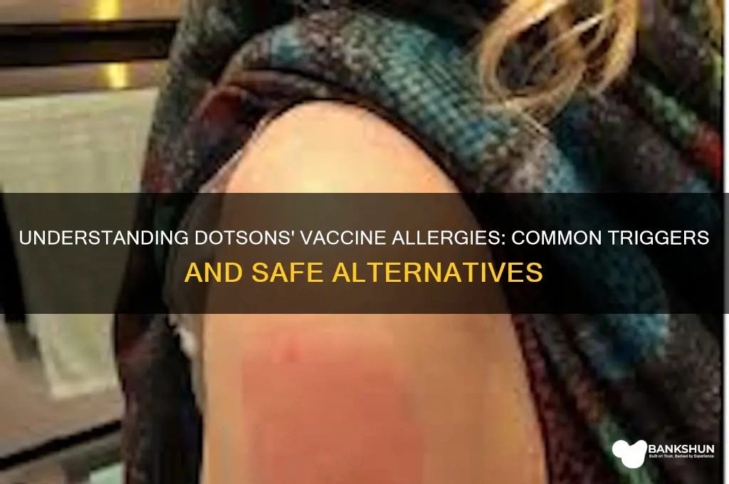 what are dotsons allergic to in vaccinations
