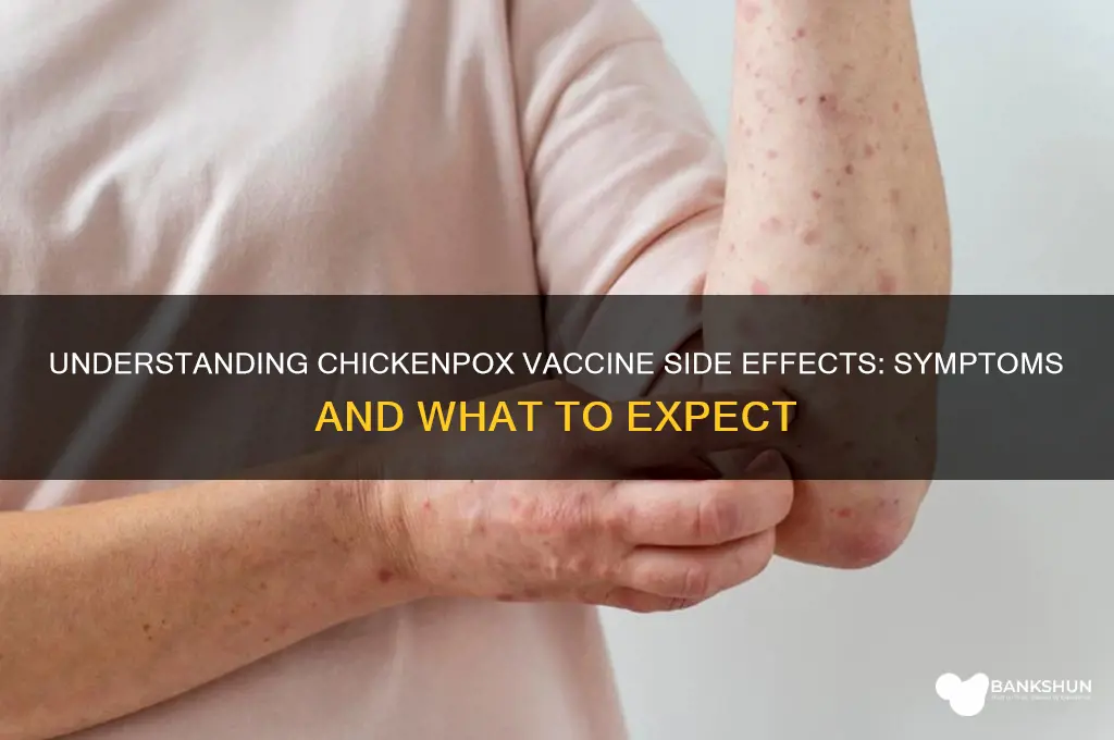 what are symptoms of chicken pox vaccine