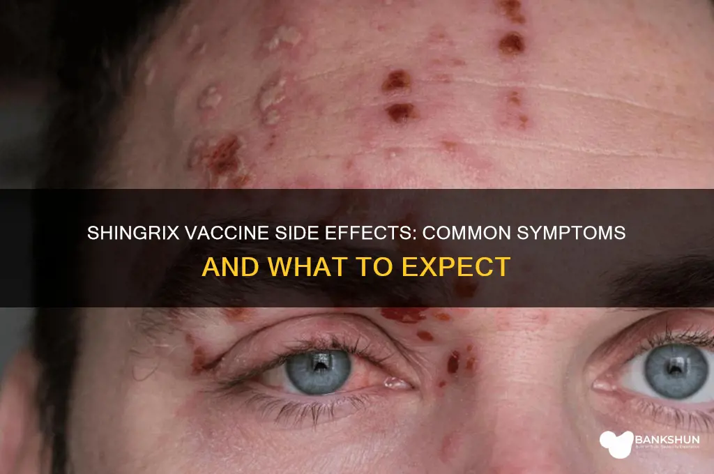 what are symptoms of the shingrix vaccination