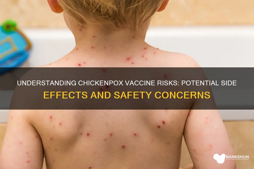 what are the risks of chickenpox vaccine
