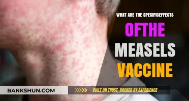 Measles Vaccine Effects: Understanding Its Specific Impact and Benefits