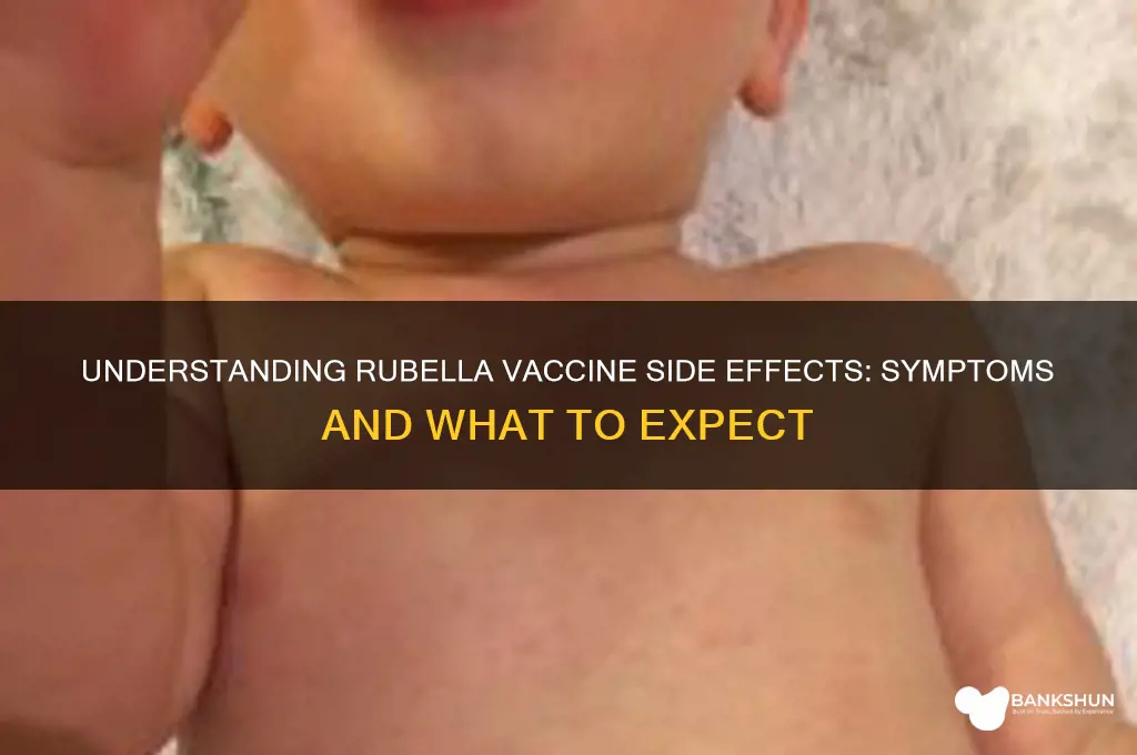 what are the symptoms of rubella vaccine
