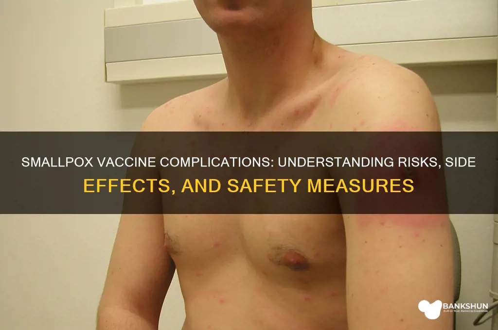 what are the vaccine complications for smallpox
