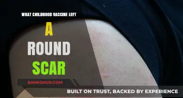 The Round Scar Mystery: Uncovering a Childhood Vaccine's Mark