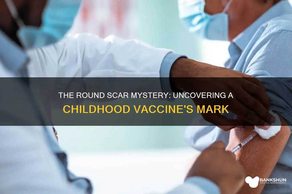what childhood vaccine left a round scar