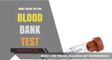 Choosing the Right Top Color for Your Blood Bank Test Visit
