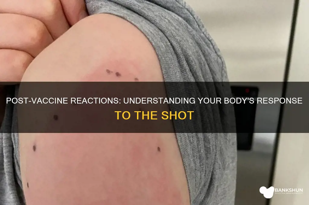 what do you feel after the vaccine