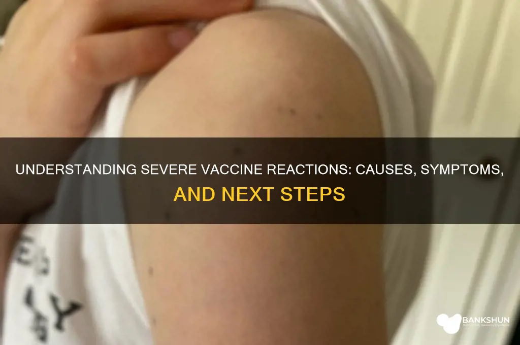 what does a bad vaccine reaction mean