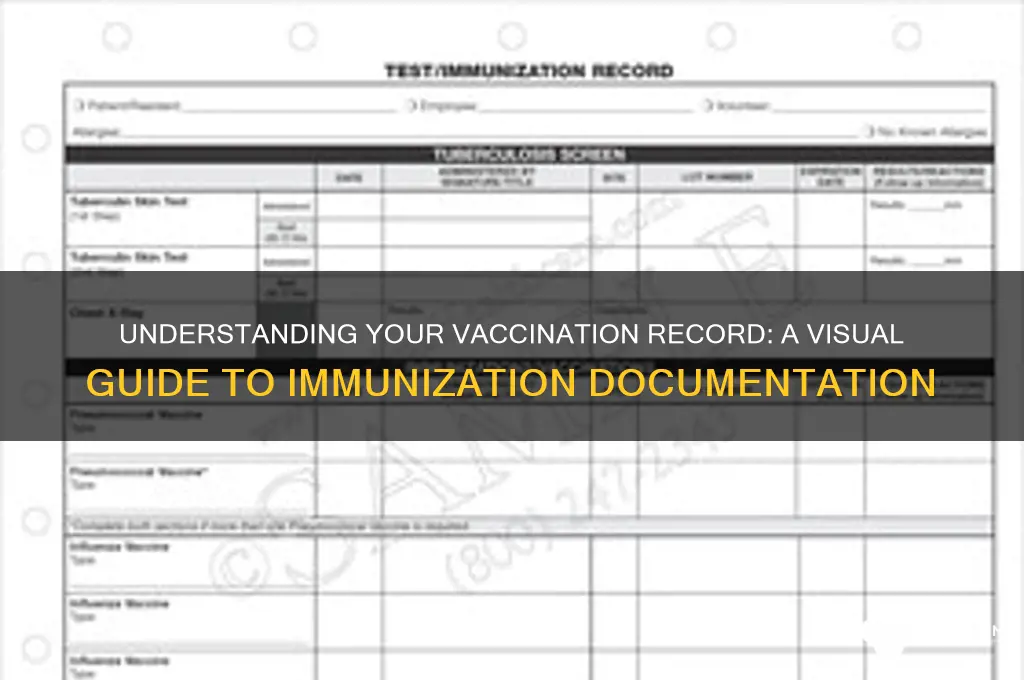 what does a vaccination record look like