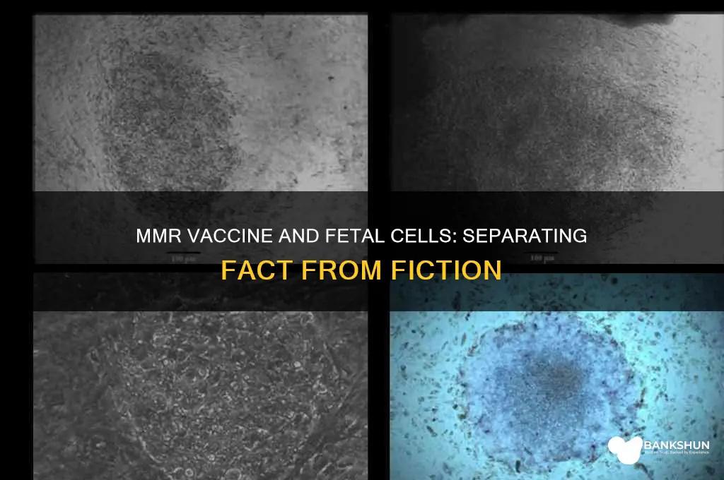 what does mmr vaccine have fetal cells