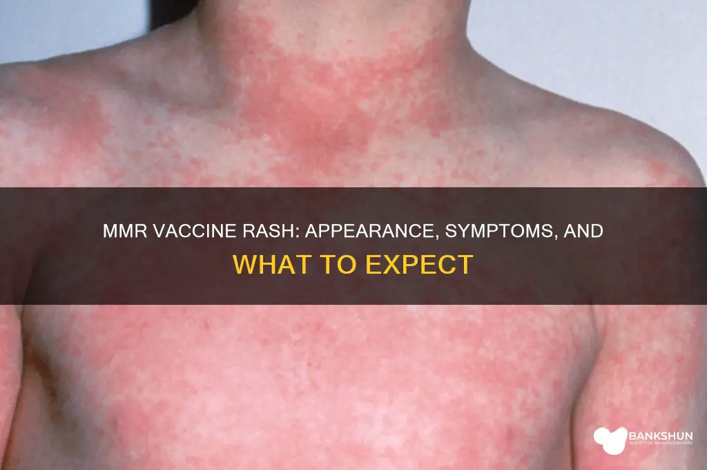 what does mmr vaccine rash look like