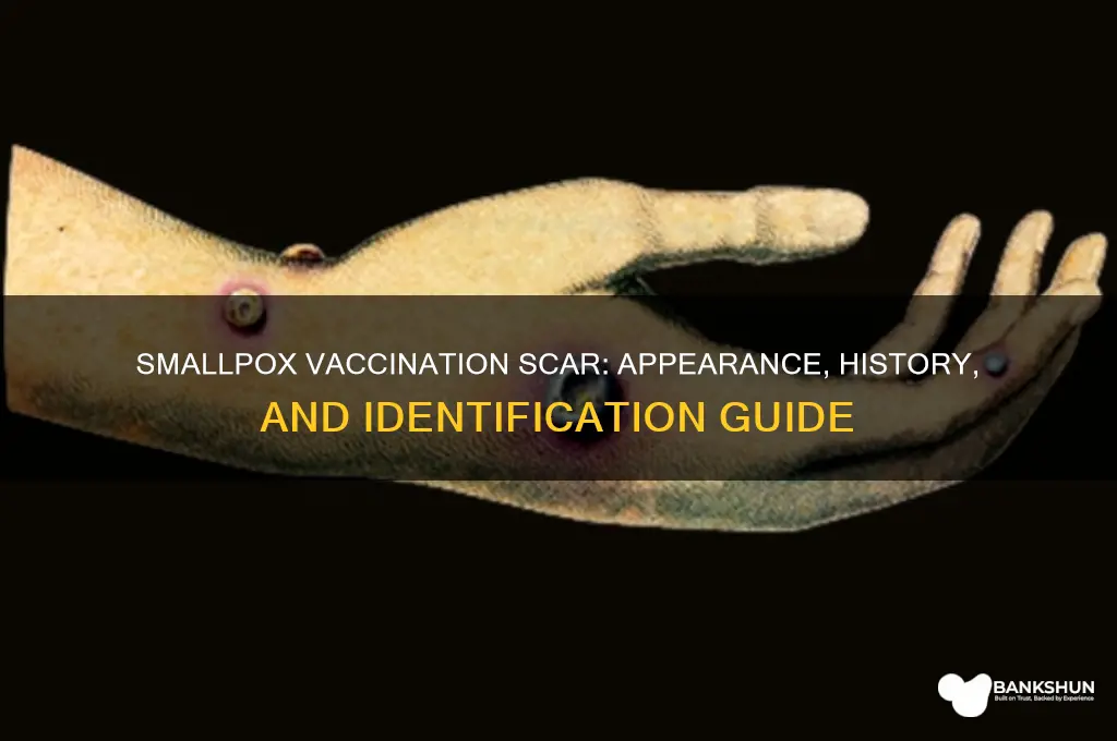 what does smallpox vaccination scar look like