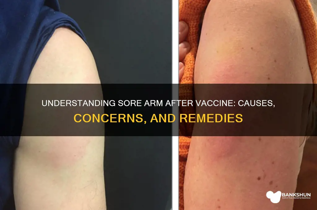 what does sore arm after vaccine mean