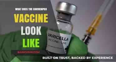 Understanding the Chickenpox Vaccine: Appearance, Dosage, and Administration