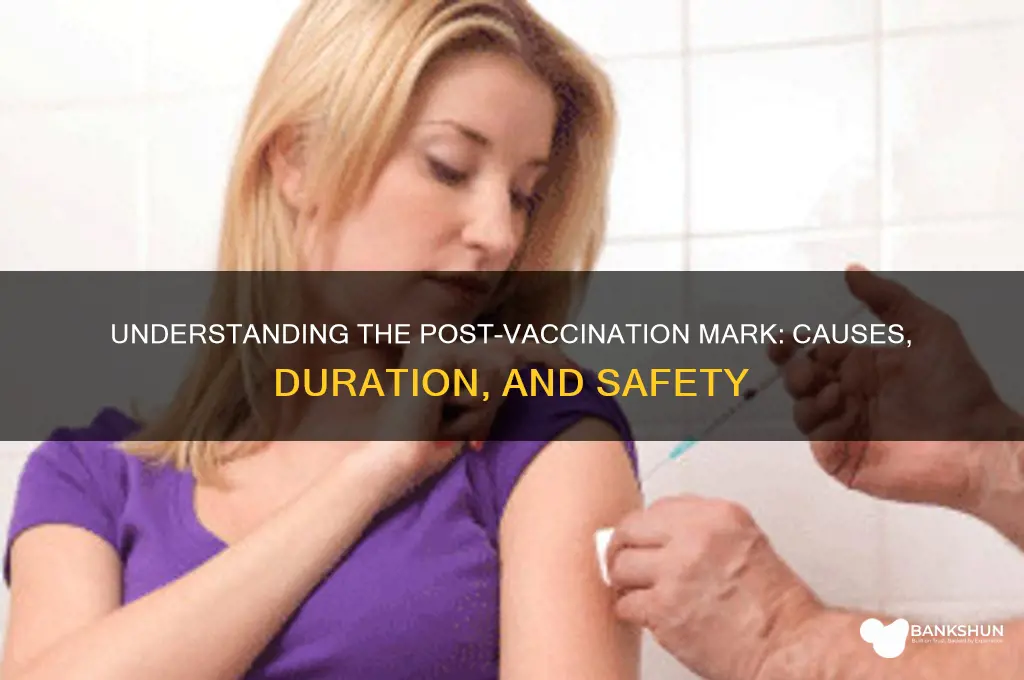 what is that mark that vaccine leave