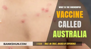 Understanding Australia's Chickenpox Vaccine: Name, Benefits, and Availability