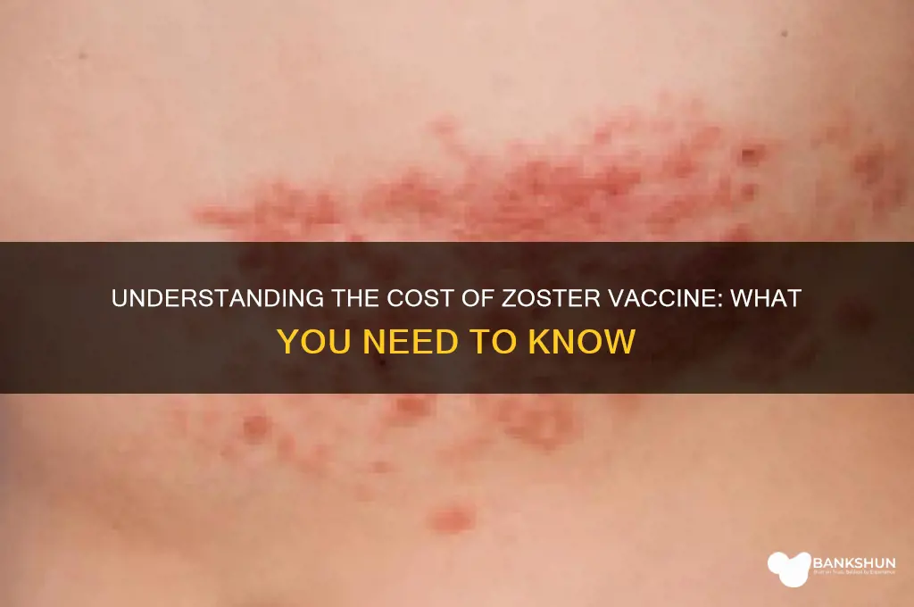 what is the cost of zoster vaccine