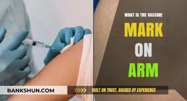 Understanding the Vaccine Mark: What That Arm Spot Means