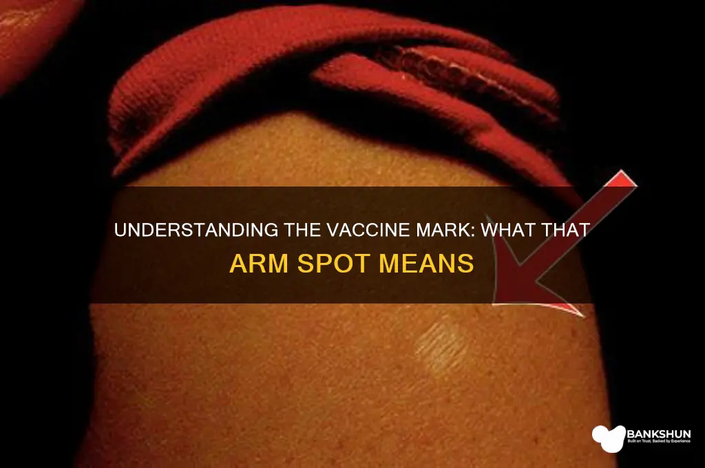 what is the vaccine mark on arm