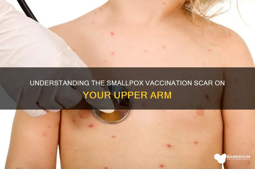 what is vaccination scar in upper arm