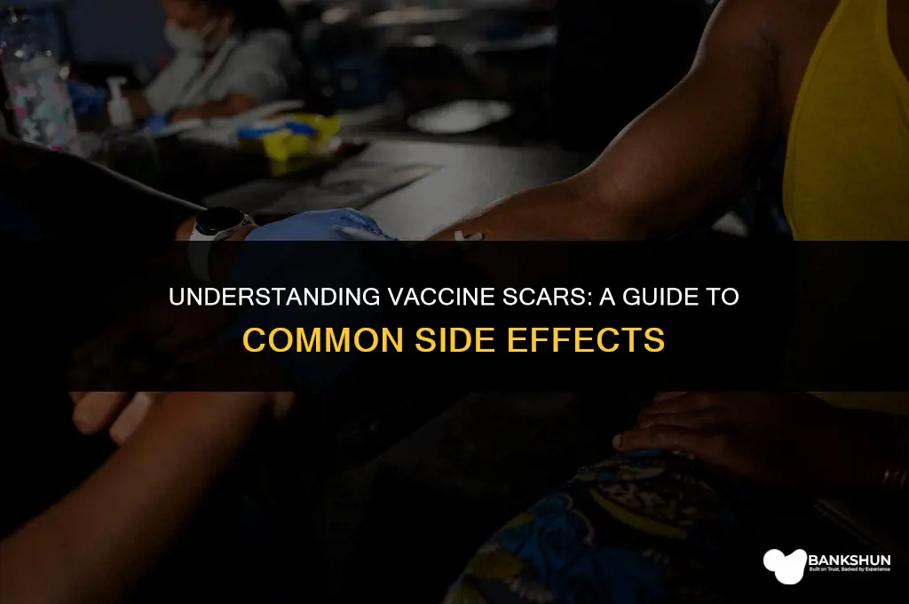 what kind of scar from a vaccine