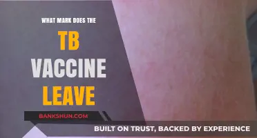 Scars of Protection: Understanding the Mark Left by the TB Vaccine