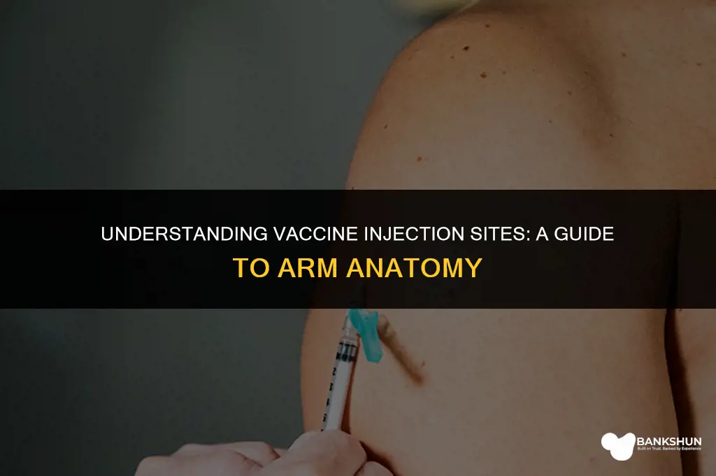 what part of arm are vaccinations injected