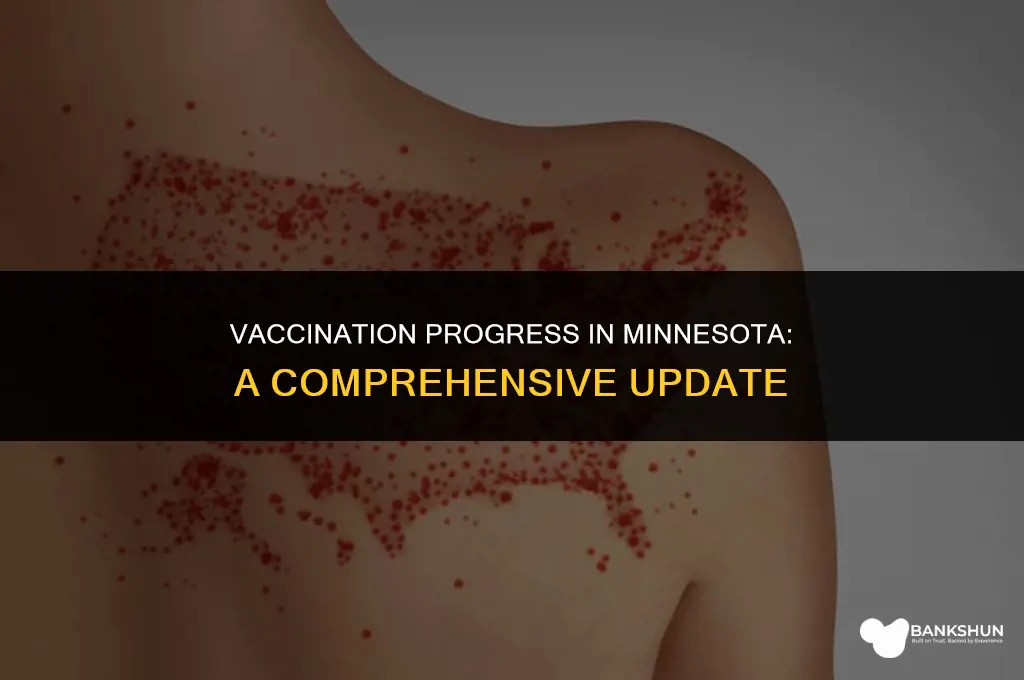 what percent of mn is fully vaccinated