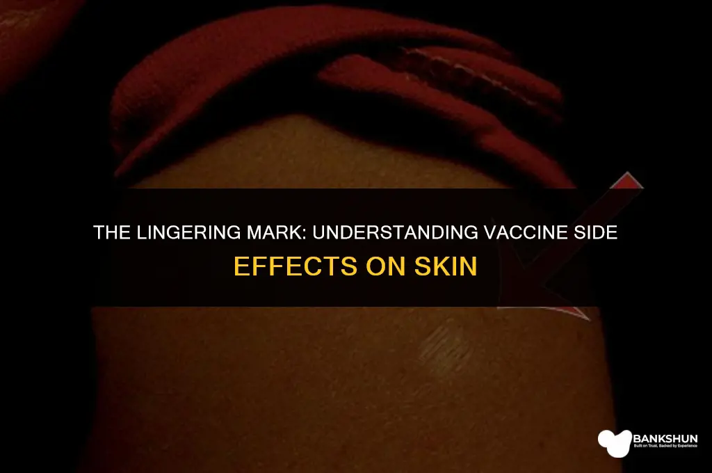 what shot vaccine left spot on shoulder