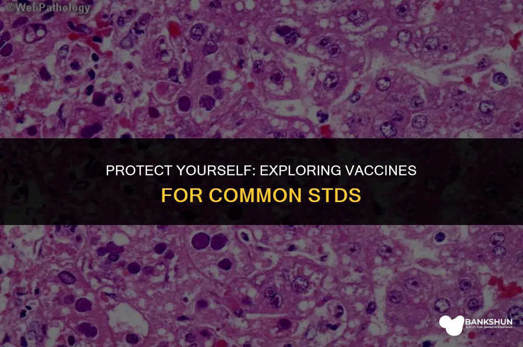 what stds have a vaccine for prevention