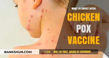 Post-Vaccination Insights: What to Expect After Your Chickenpox Shot