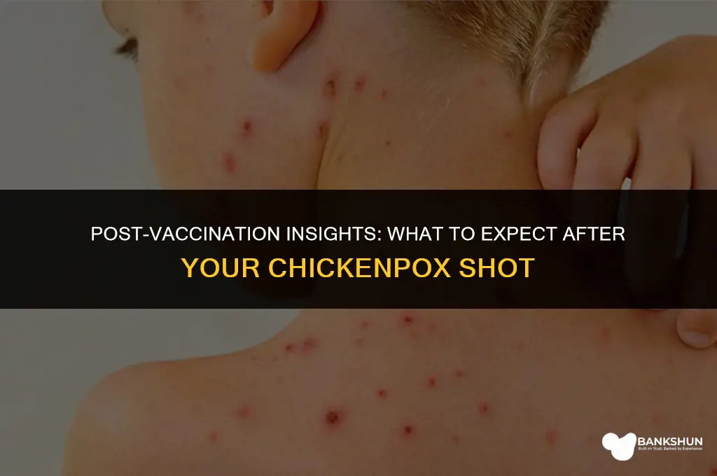 what to expect after chicken pox vaccine