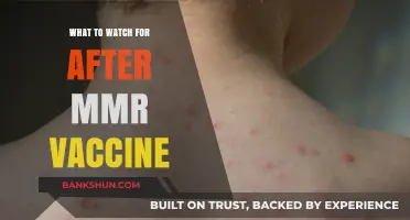 Post-MMR Vaccine Vigilance: Key Symptoms to Monitor