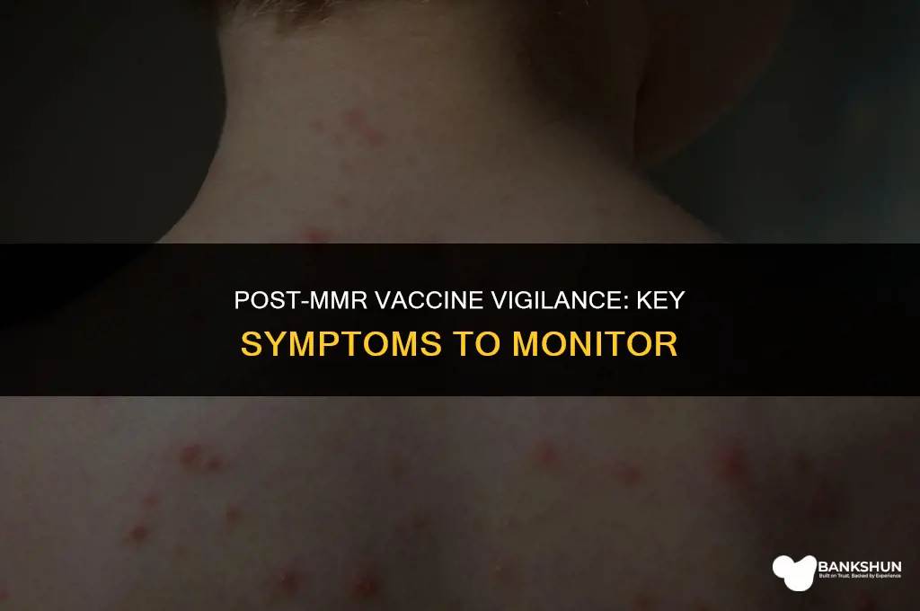 what to watch for after mmr vaccine
