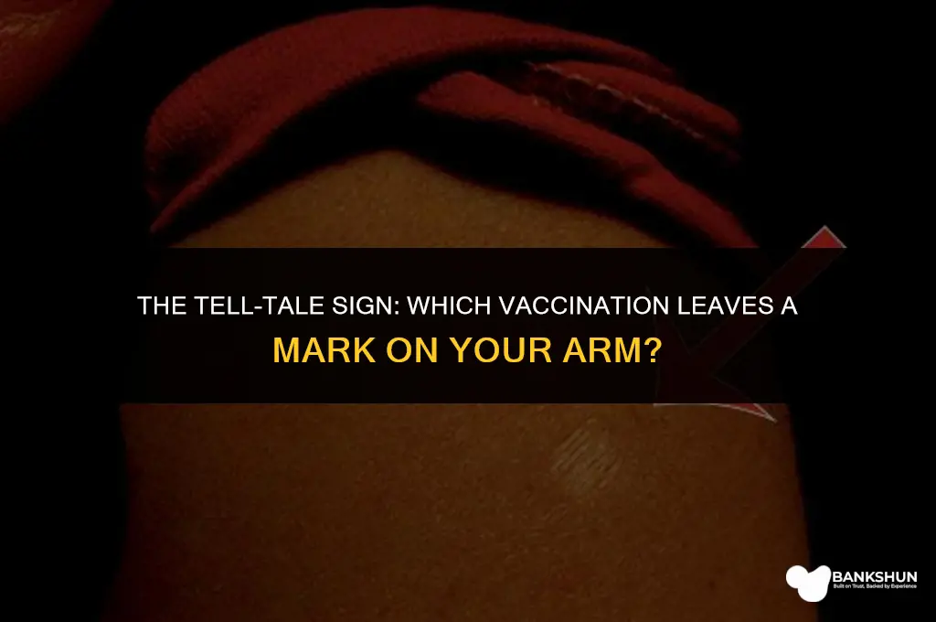 what vaccination leaves a mark on arm