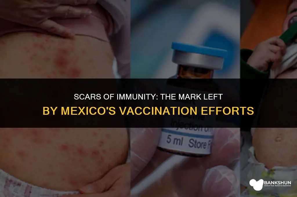 what vaccine in mexico leaves a mark