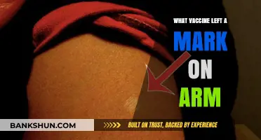 The Unexpected Side Effect: Vaccine Leaves a Mark on Arm