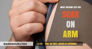 The Unexpected Side Effect: Vaccine Scars and What They Mean