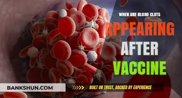 Understanding the Timing of Blood Clots Post-Vaccination: A Comprehensive Guide