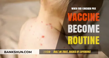 From Concern to Routine: The Journey of the Chicken Pox Vaccine