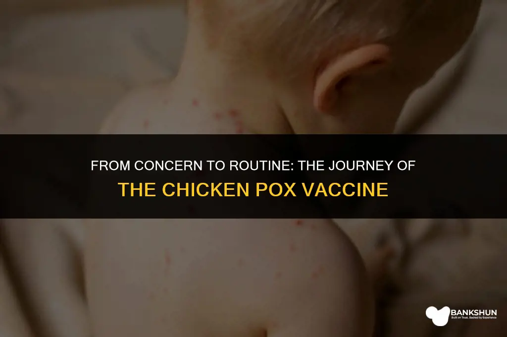 when did chicken pox vaccine become routine