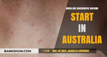 A Historical Look: Chickenpox Vaccine's Journey in Australia
