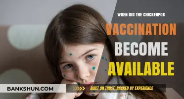 Unveiling the History: Chickenpox Vaccination's Journey to Availability