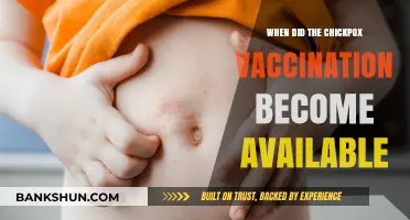 Unveiling the History: When Did the Chickenpox Vaccine Debut?