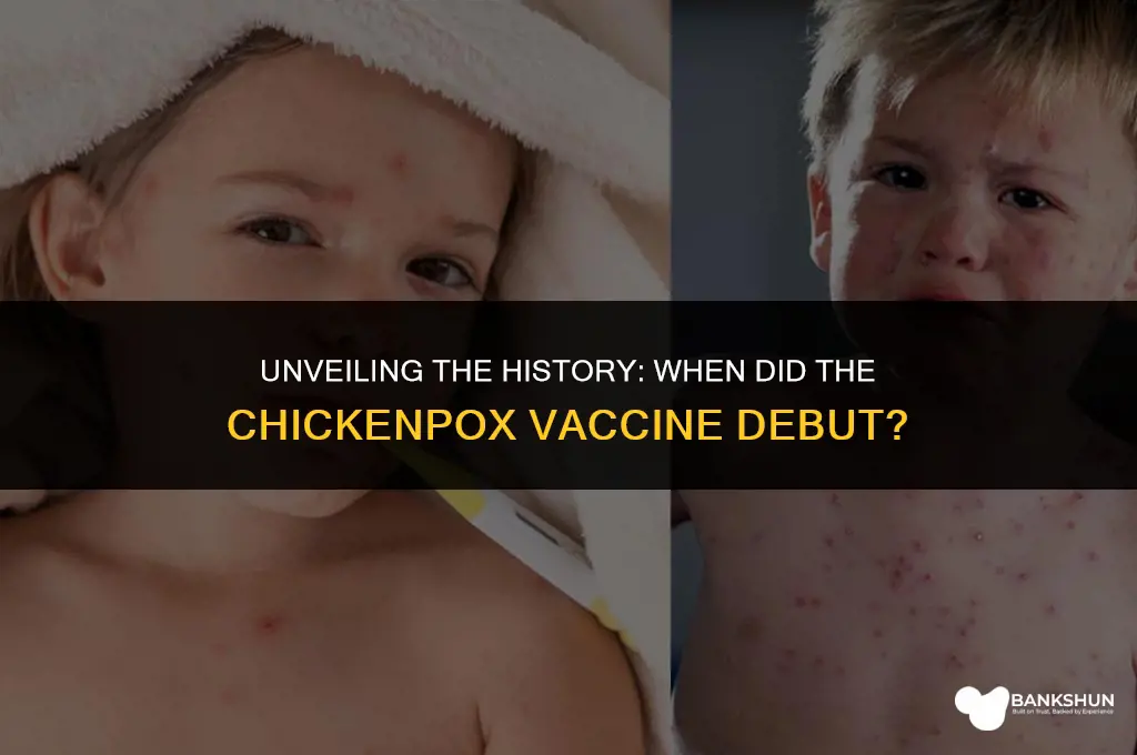 when did the chickpox vaccination become available