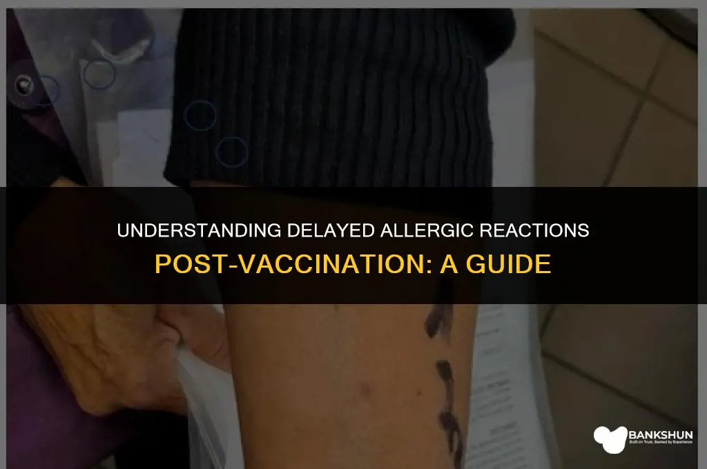 when do allergic reactions occur after vaccine