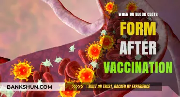 Understanding Blood Clot Formation Post-Vaccination: A Comprehensive Guide